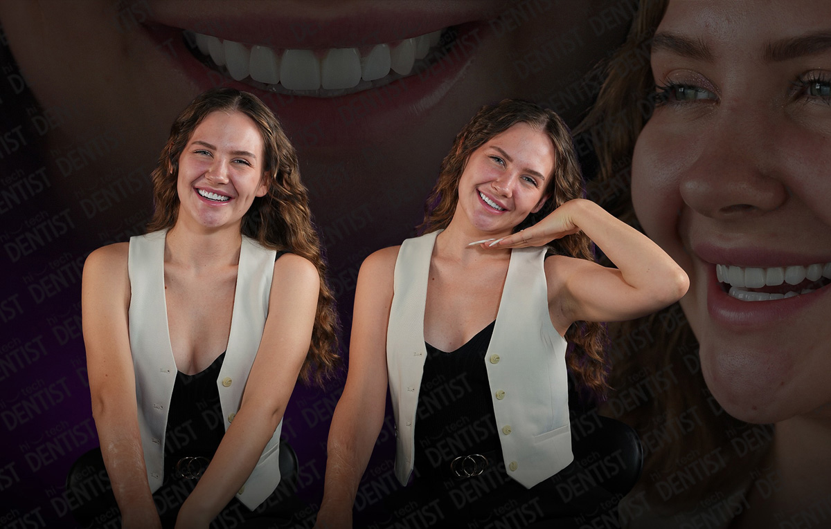 Teeth Polishing